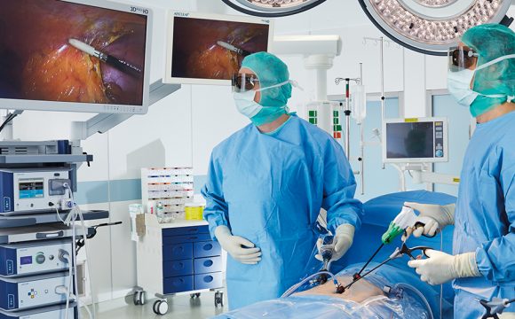 Minimal Invasive Surgery img