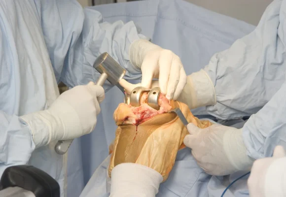 Orthopedics img